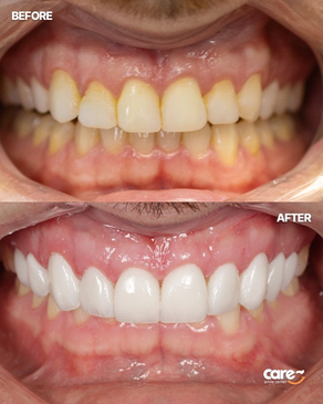 Slider image (5) Care Smile Center